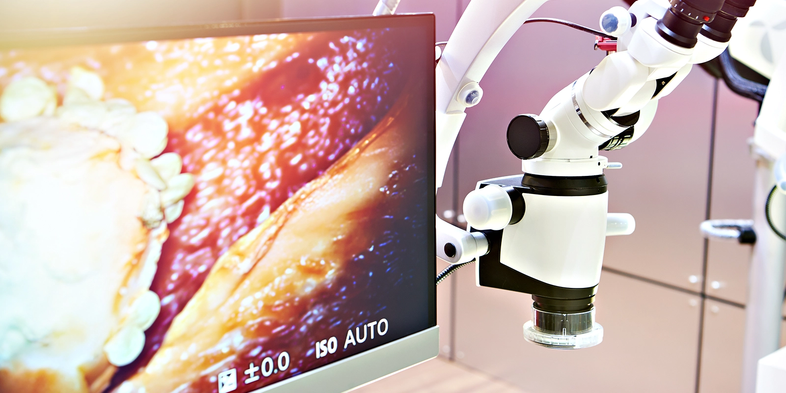 マイクロスコープについて