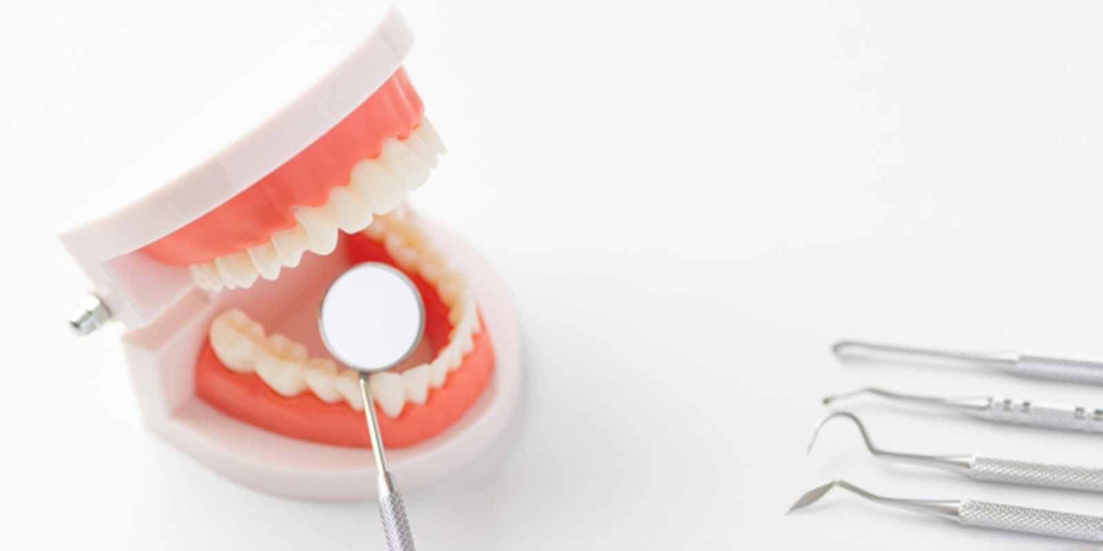 ホワイトスポットとは