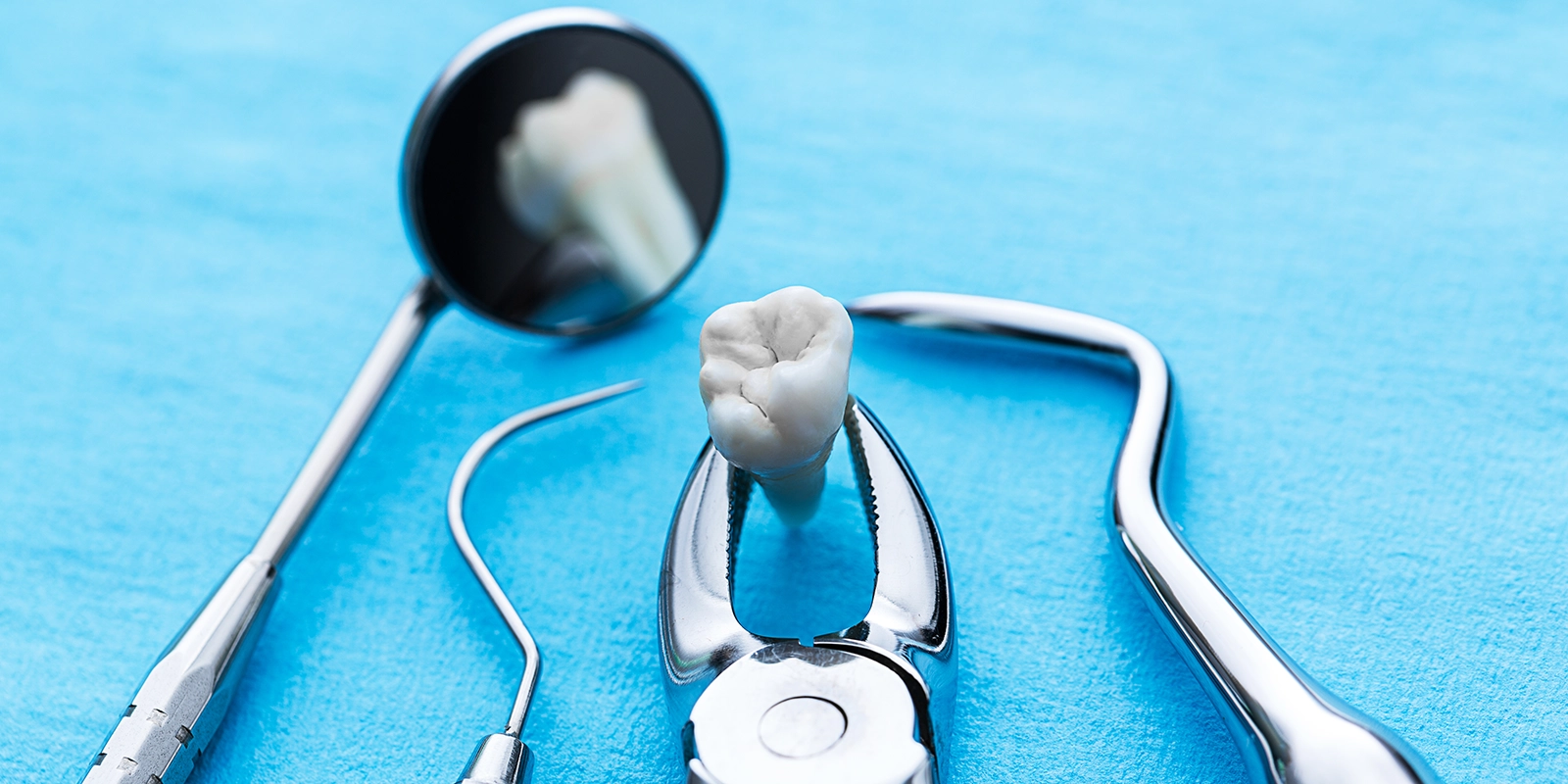 親知らずを抜歯する理由